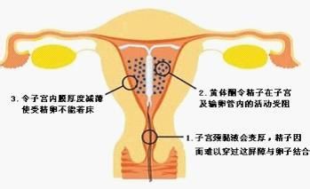 福州哪家妇科医院可以取环 取环后多久可以再次怀孕?